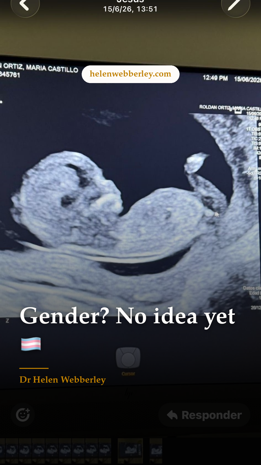 Gender? No idea yet 🏳️‍⚧️