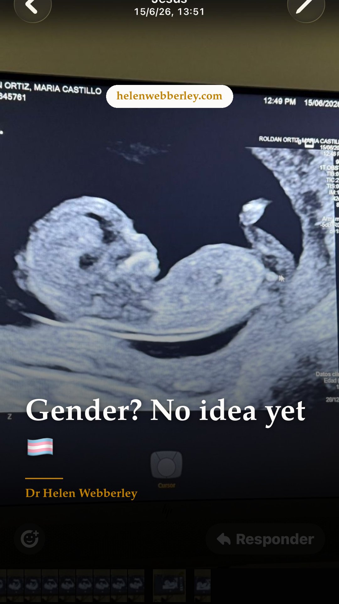 Gender? No idea yet 🏳️‍⚧️
